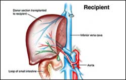 liver organ donation